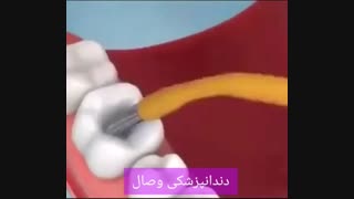 فیلم پر کردن دندان