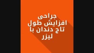 فیلم جراحی افزایش طول تاج دندان با لیزر