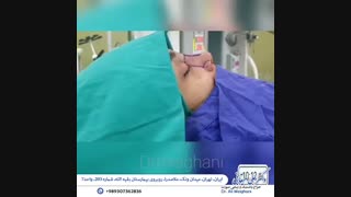 رینوپلاستی
