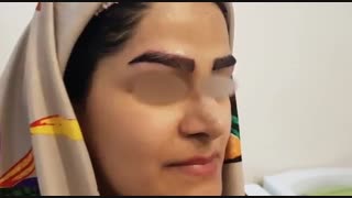 کاشت ابرو به سبک جدید