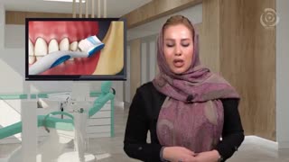 مراقبت های بعد ایمپلنت دندان یا کاشت دندان