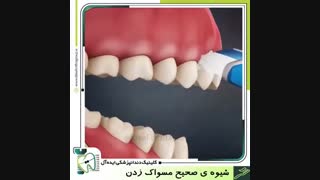شیوه صحیح مسواک زدن | کلینیک دندانپزشکی ایده آل