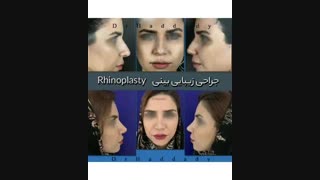 جراحی زیبایی بینی