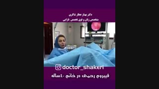 فیبروم رحمی در خانم 40 ساله