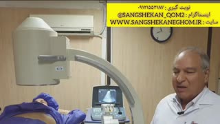 سنگ شکنی سنگ حالب eswl