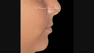ارتودنسی شمال تهران | متخصص ارتودنسی