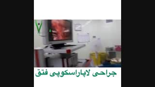 جراحی لاپاراسکوپی فتق