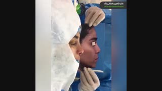 ویدئوی عمل بینی ترمیمی بسیار مشکل