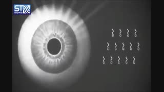 روش های رساندن دارو به چشم