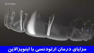 مزایای درمان ارتودنسی با اینویزالاین | دکتر مهریزی