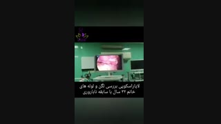 لاپاراسکوپی لگن خانم 32 ساله
