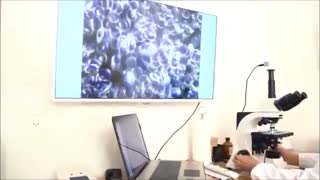 تاثیرات امواج موبایل بر روی اکسیژن در خون و تاثیر در روند حرکتی گلبولهای قرمز