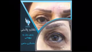خدمات کلینیک پوست مو زیبایی آنیل