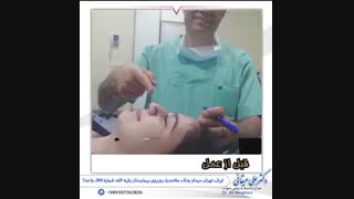 فیلم سه ماه بعد از عمل بینی گوشتی