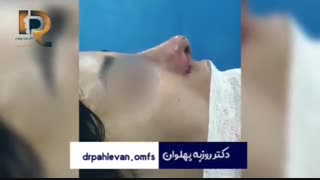 فیلم جراحی بینی