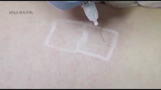 پلاسما مگلو