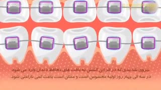 آیا ارتودنسی درد دارد؟ | دکتر سپیده دادگر