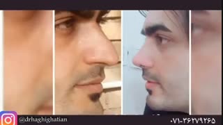 جراح بینی در شیراز