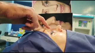 عمل بینی پهن و گوشتی | دکتر ابراهیمی آر اف فرکشنال