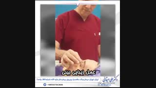 فیلم عمل زیبایی بینی