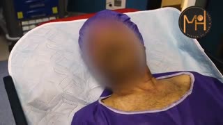 فیلم تومور زبان!