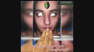 جراحی بینی گوشتی و پیچدار