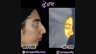جراحی بینی | دکتر رفیع