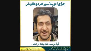 فیلم جراحی زیبایی گوش