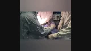 زایمان سزارین بدون سانسور