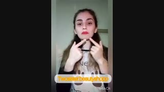 انواع جوش و جوش سر سفید