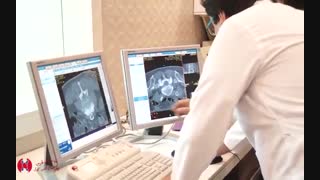 پیشرفته ترین تکنولوژی تصویربرداری در بخش تصویربرداری و سی تی اسکن بیمارستان کوثر شیراز