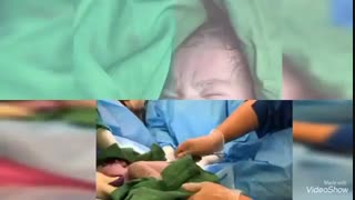 بریدن بند ناف توسط پدر در زایمان طبیعی