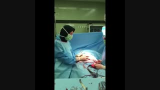 فیلم خارج کردن فیبروم رحم