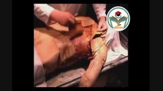 جلسات مجازی آنلاین تشریح تئوری اندام های انسان همراه با قسمت هایی واقعی تشریح بدن انسان (نبینی از دستت رفته)