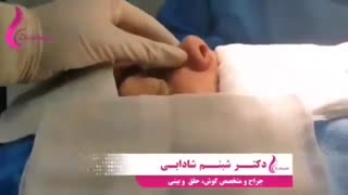 فیلم عمل جراحی زیبایی بینی (قسمت دوم)