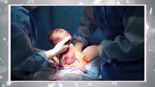 عمل سزارین در تهران