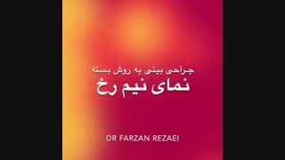 فیلم جراحی بینی بعد از 2 سال