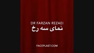 فیلم سه ماه بعد از جراحی بینی