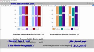 تاثیر لورتا نوروفیدبک بر ADHD  یا بیش فعالی بزرگسالان