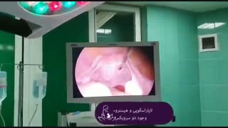 لاپاراسکوپی و هیستروسکوپی در خانم نابارور