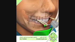 دستگاه فیس ماسک | دکتر لادن طیبی