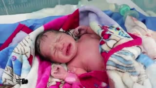 زایمان سزارین توسط دکتر ندا حاجیها