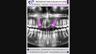 اجرای نمونه درمان ویدیویی برای جناب دکتر فاضل فیروزی | راهنمای لبخند