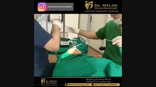 انجام 16 واحد ایمپلنت در یک روز